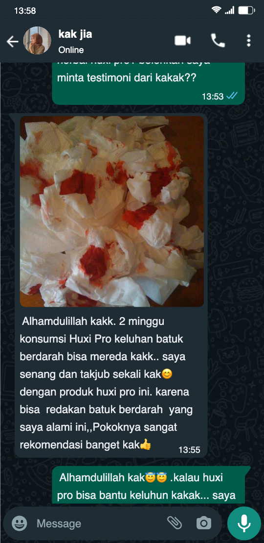 testi Huxi Pro new 3